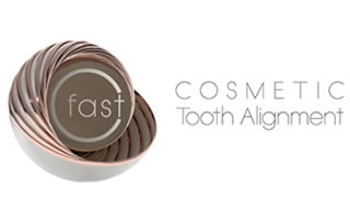 Cfast cosmetic braces